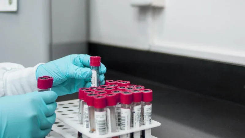 Analiza diagnozy boreliozy: Metody i znaczenie